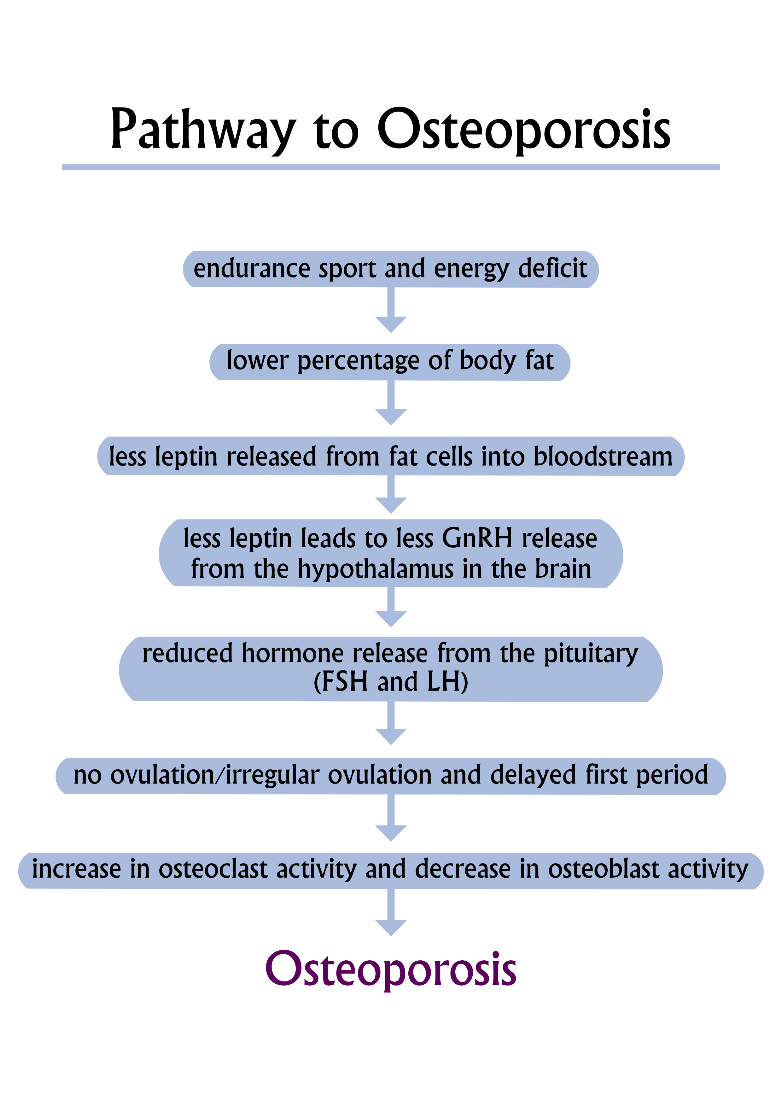 Osteoporosis essay